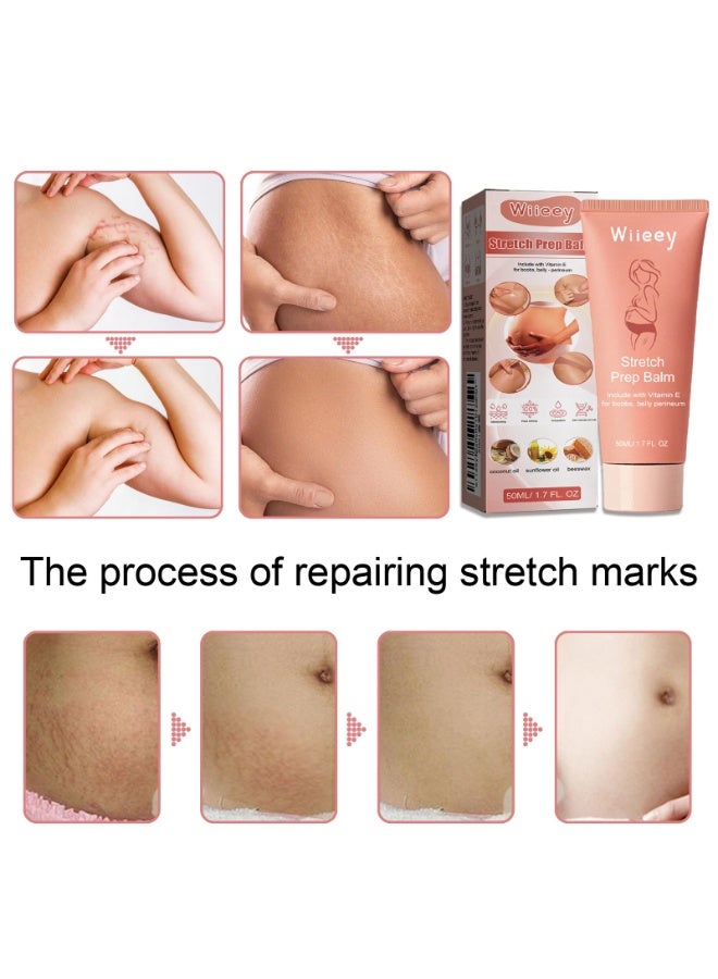 Wiieey Postpartum Repair Massage Cream 50ml is specially formulated for pregnant and postpartum skin. It gently nourishes and smooths skin, improves elasticity, and firms the abdomen. - Image 4